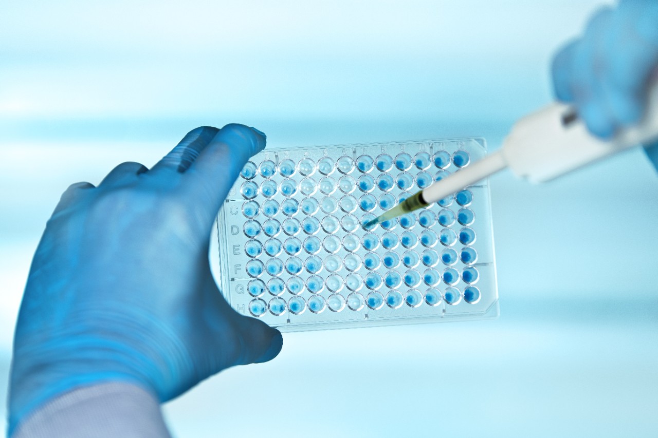 Hände eines Wissenschaftlers im biochemischen Labor mit Pipette und Multiwells-Platte/Techniker beim Pipettieren von Multiwell-Platten im Labor
