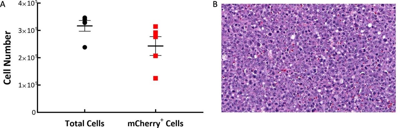 Fig. 1: C1498-Luc-mCherry tumor composition in C57BL/6 mice. A: Tumors are mostly composed of mCherry+ cells. B: A representative H&E-stained section showing neoplastic cells with pleomorphic nuclei and multiple mitotic figures, 20X original magnification.