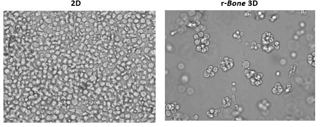 図 1：ヒト骨髄細胞 U266B1 の 2D 培養と骨再建（r-Bone）3D 培養
