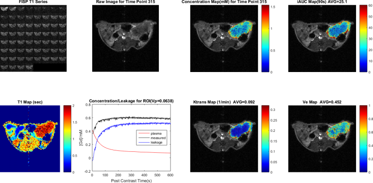 Analyse der Tumorpermeabilität unter Verwendung von REDCAT™ für die DCE-MRT-Analyse