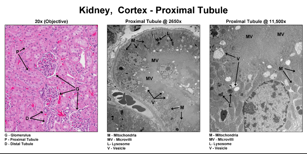 Niere, Kortex – Proximaler Tubulus